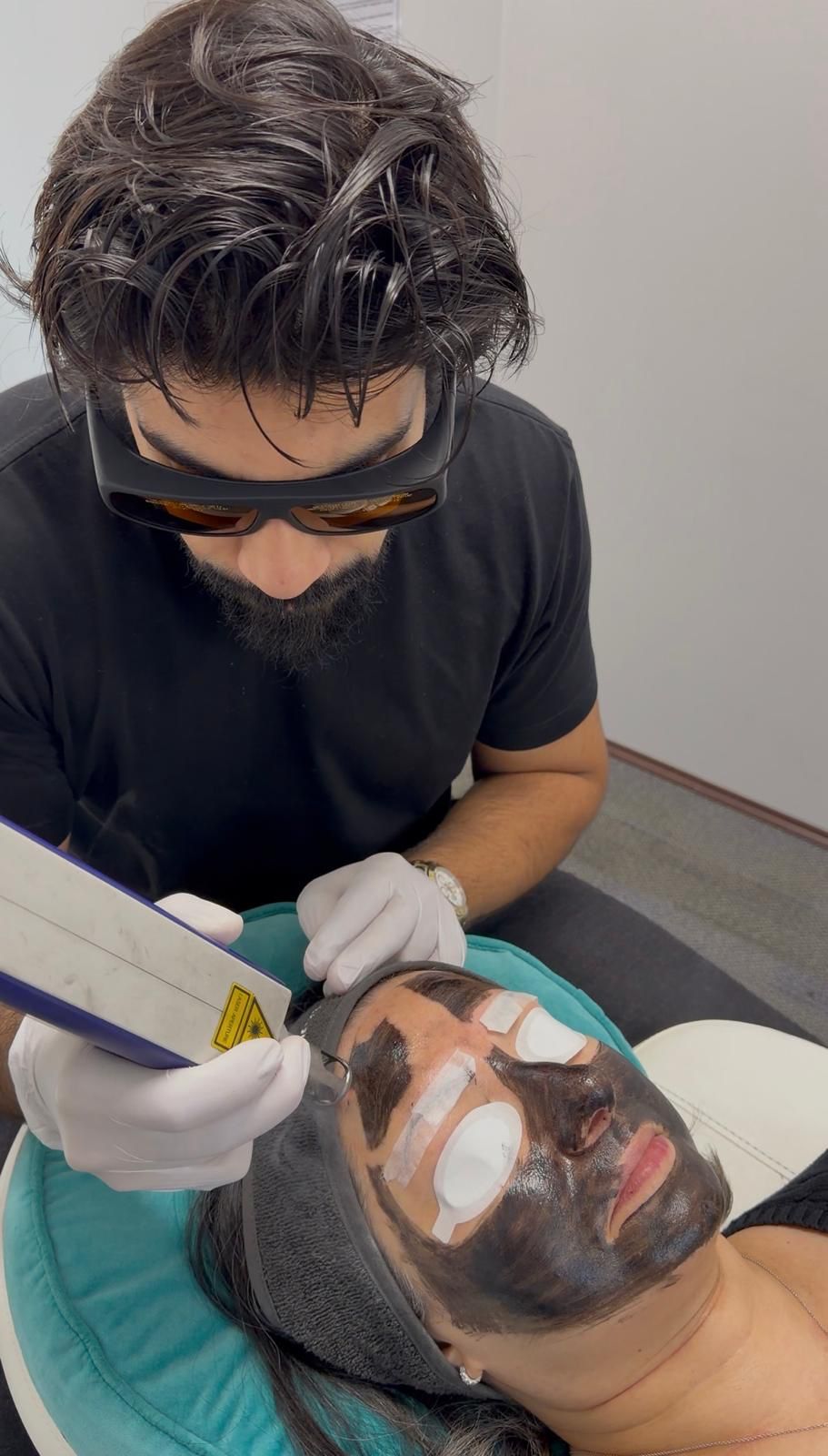 Top 10 Benefits of a Carbon Laser Peel